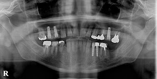 PBN05_150901180723(調整後)